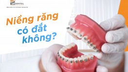 Niềng răng có đắt không? Giá niềng răng 2024 bao nhiêu?