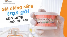 Giá niềng răng trọn gói cho từng mức độ răng hiện nay