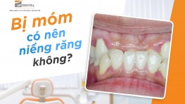 [Giải đáp thắc mắc] Răng móm có niềng được không