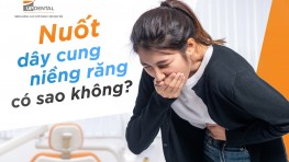 [Giải đáp] Nuốt dây cung niềng răng có sao không?