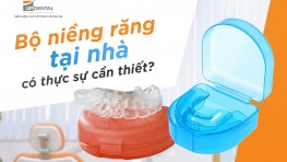 [Thắc mắc] Bộ niềng răng tại nhà có thực sự hiệu quả?