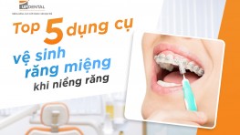 Top 5 dụng cụ vệ sinh răng miệng khi niềng răng bạn nên biết