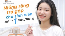 Top 10 địa chỉ niềng răng trả góp cho sinh viên uy tín tại TP.HCM