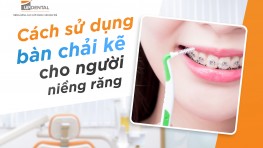 Cách sử dụng bàn chải kẽ cho người niềng răng