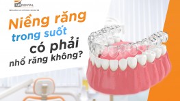 [Giải đáp] Niềng răng trong suốt có phải nhổ răng không?