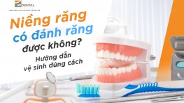 [Giải đáp thắc mắc] Niềng răng có đánh răng được không?