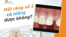 [Giải đáp thắc mắc] Mất răng số 2 có niềng được không?