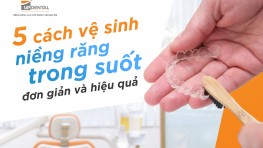 5 cách vệ sinh niềng răng trong suốt đơn giản và hiệu quả