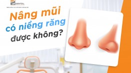 [Giải đáp] Nâng mũi có niềng răng được không?