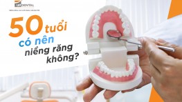 50 tuổi có nên niềng răng không, niềng hiệu quả không?