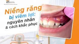 Niềng răng bị viêm lợi: nguyên nhân và cách khắc phục