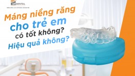 Máng niềng răng cho trẻ em có tốt không? Hiệu quả không?