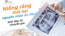 [Giải đáp] Niềng răng thất bại nguyên nhân do đâu?