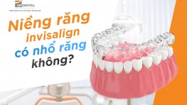 [Giải đáp] Niềng răng Invisalign có nhổ răng không?