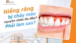 Niềng răng bị chảy máu nguyên nhân do đâu? Phải làm sao?