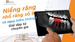 [Thắc mắc] Niềng răng nhổ răng số 8 có nguy hiểm không?