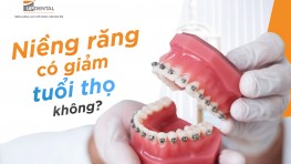 Niềng răng có giảm tuổi thọ không?