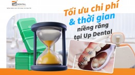 Tối ưu chi phí và thời gian niềng răng tại Up Dental 