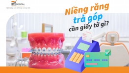 Niềng răng trả góp cần giấy tờ gì? [Giải đáp thắc mắc]