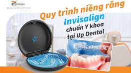 Quy trình niềng răng Invisalign chuẩn Y khoa tại Up Dental