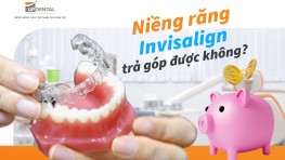 Niềng răng Invisalign trả góp được không? [Giải đáp]