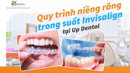 Niềng răng trong suốt Invisalign là gì?