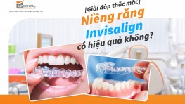 Niềng răng Invisalign có hiệu quả không? [Giải đáp thắc mắc]