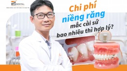 Giá niềng răng mắc cài sứ [tháng 09/2024] tại Up Dental