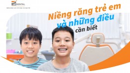 Niềng răng trẻ em và những thông tin cần biết trước