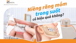 Niềng răng móm trong suốt có hiệu quả không?