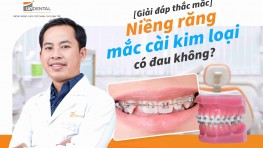 Niềng răng mắc cài kim loại có đau không? [Giải đáp]