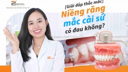 Niềng răng mắc cài sứ có đau không? [Giải đáp thắc mắc]