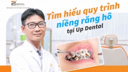 Tìm hiểu quy trình niềng răng hô tại Up Dental