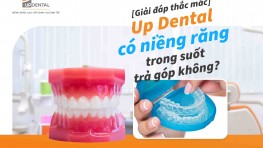 Niềng răng trong suốt trả góp ở Up Dental được không?