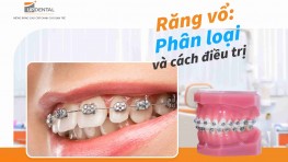 Răng vổ: Phân loại và cách điều trị