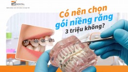 Có nên chọn gói niềng răng 3 triệu không?