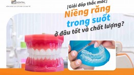 Niềng răng trong suốt ở đâu tốt và chất lượng? [Giải đáp]