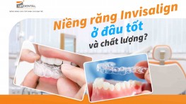Niềng răng Invisalign ở đâu tốt và chất lượng?
