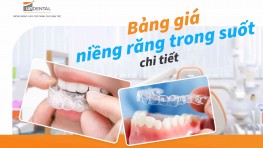 Bảng giá niềng răng trong suốt mới nhất tại Up Dental