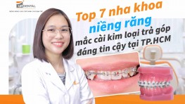 Top 7 Nha khoa niềng răng mắc cài kim loại trả góp đáng tin cậy tại TP.HCM