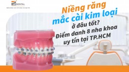 Top 8 nha khoa niềng răng mắc cài kim loại tại TPHCM