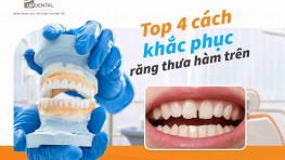 Top 4 cách khắc phục răng thưa hàm trên