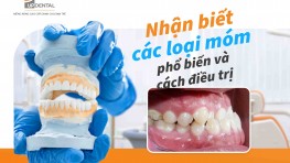 Nhận biết các loại móm phổ biến và cách điều trị