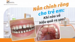 Nắn chỉnh răng cho trẻ em: Khi nào và hiệu quả ra sao?