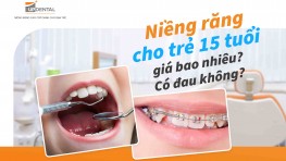 Niềng răng cho trẻ 15 tuổi giá bao nhiêu? Có đau không?