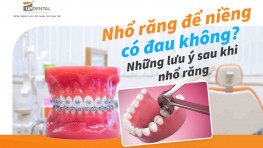 Nhổ răng để niềng có đau không? Những lưu ý sau khi nhổ răng