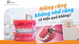 Niềng răng không nhổ răng có hiệu quả không?