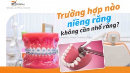 Trường hợp nào niềng răng không cần nhổ răng?