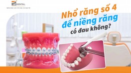 Nhổ răng số 4 để niềng răng có đau không? [Giải đáp]