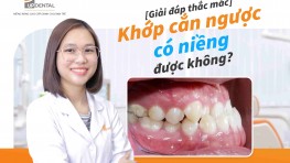 Giải đáp: Khớp cắn ngược có niềng được không?